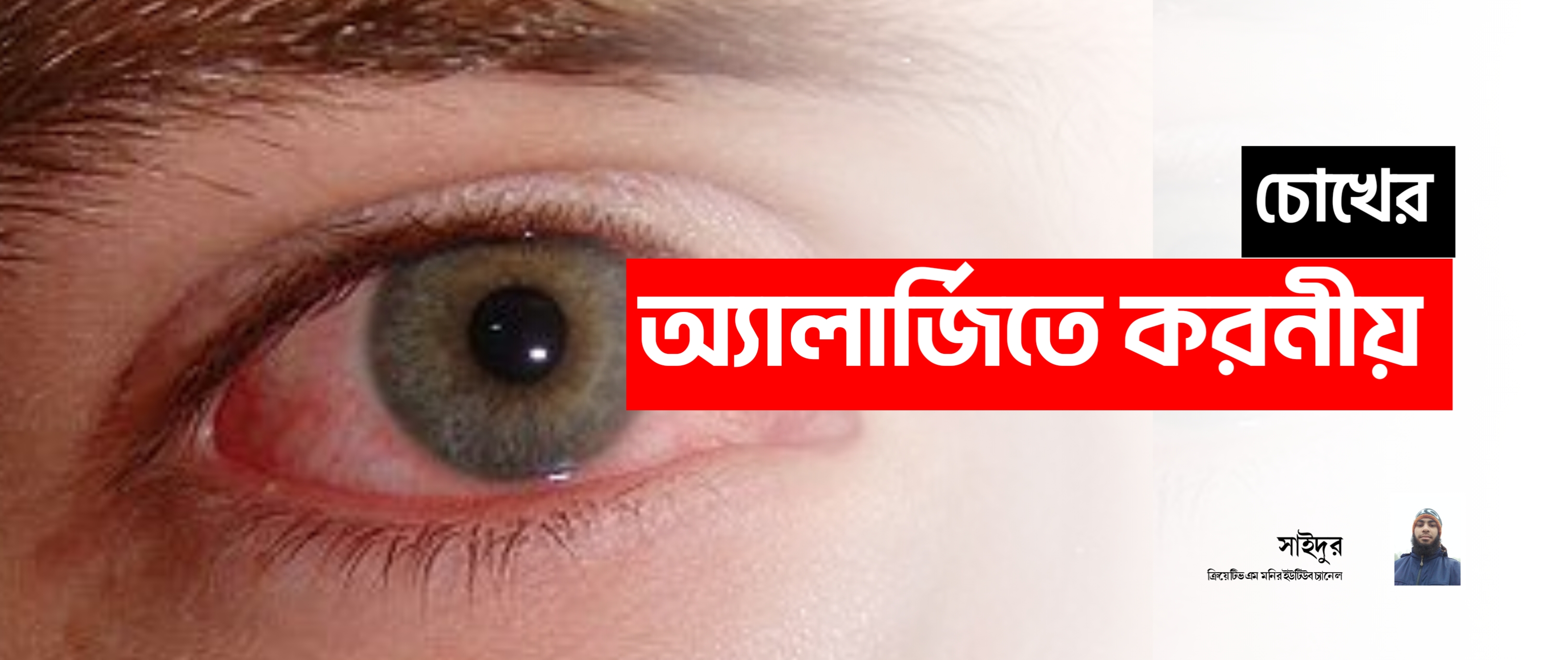 অ্যালার্জি